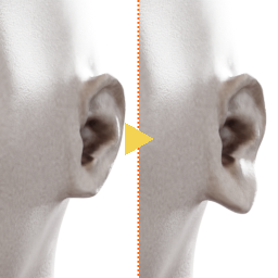 elvs_ear_flap_bottom_out.png